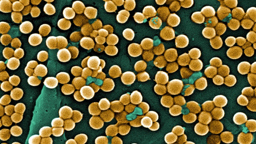 Global Efforts Intensify in Fight Against New Resistant Superbugs